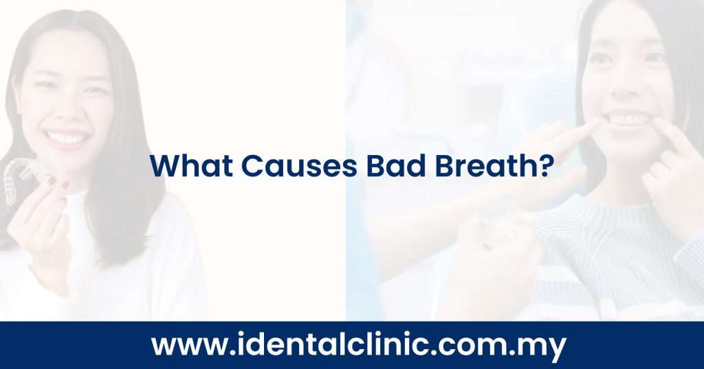 What Causes Bad Breath