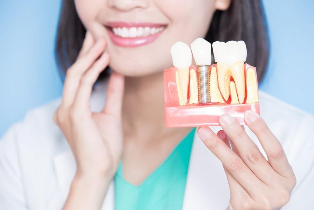 dental implant malaysia