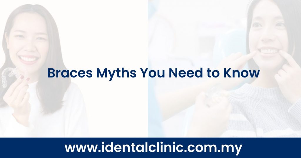 Braces Myths You Need to Know
