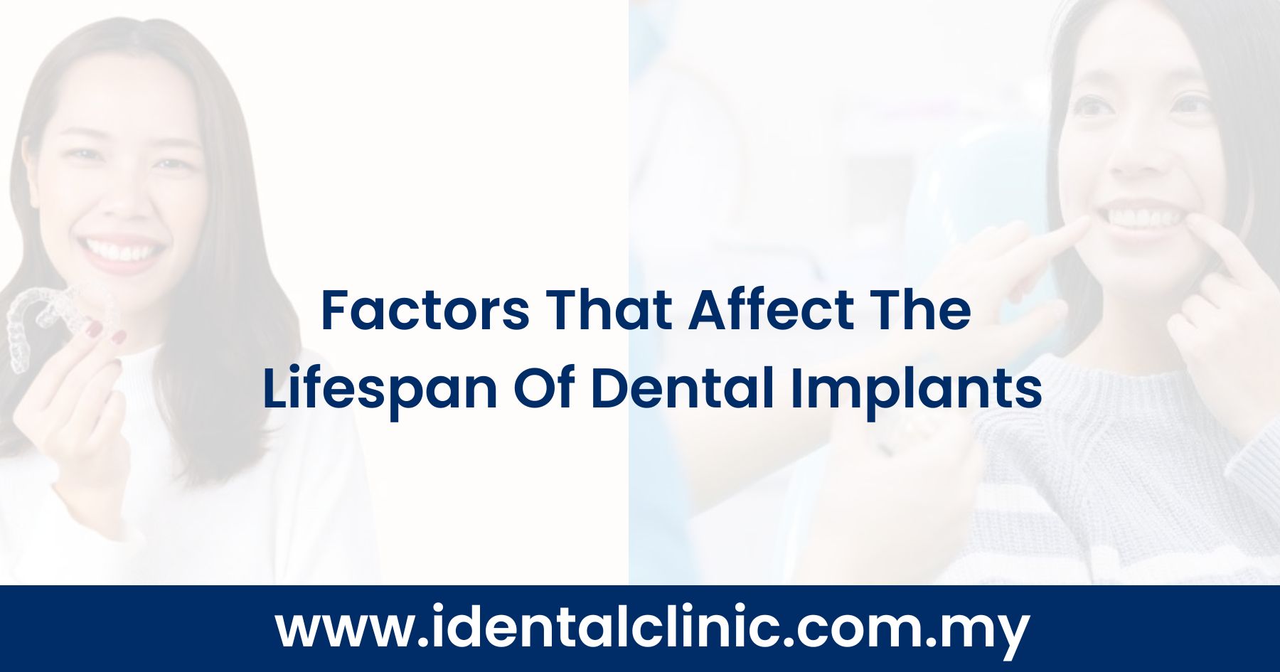 Factors That Affect The Lifespan Of Dental Implants