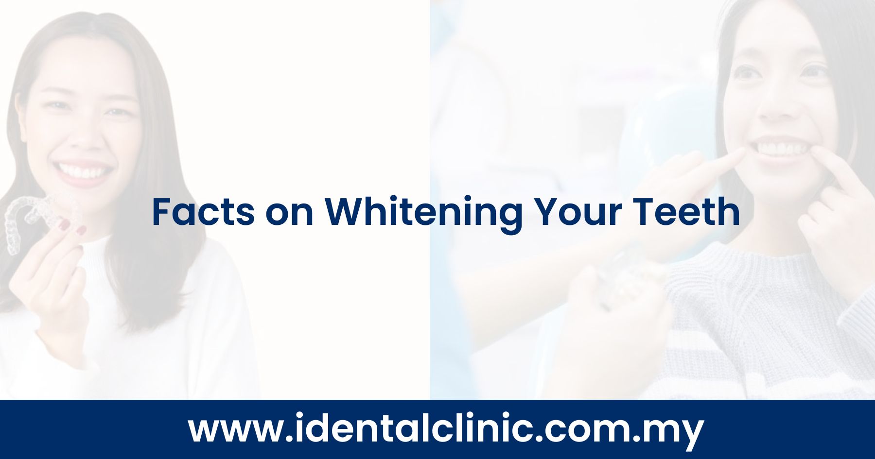 Facts on Whitening Your Teeth