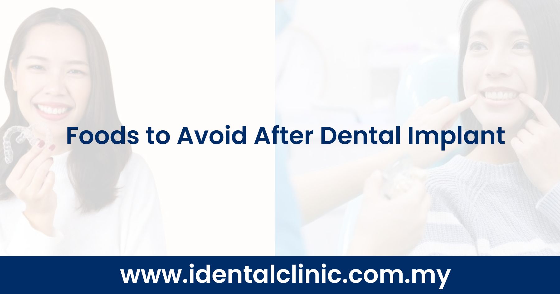 Foods to Avoid After Dental Implant