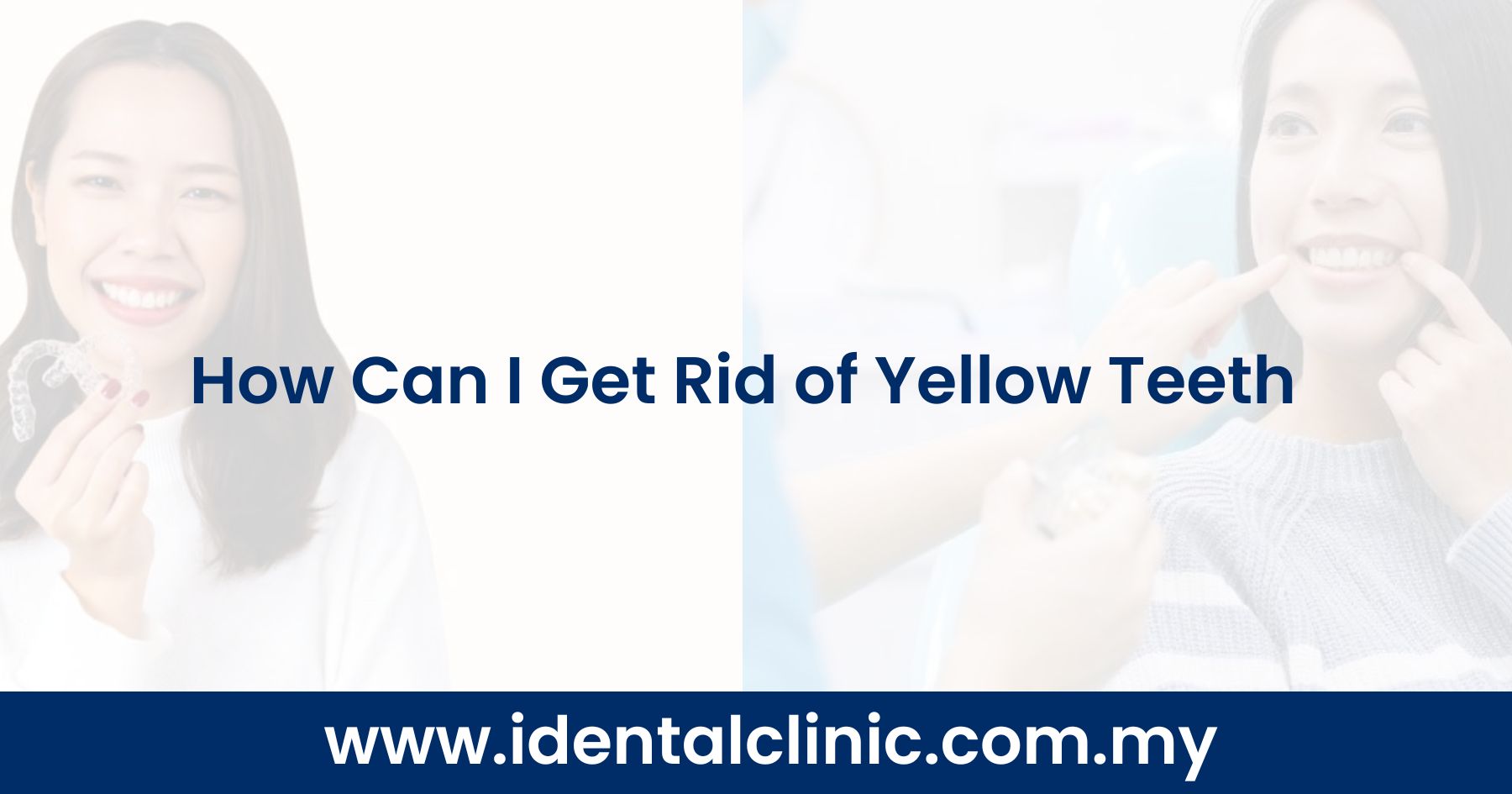 How Can I Get Rid of Yellow Teeth