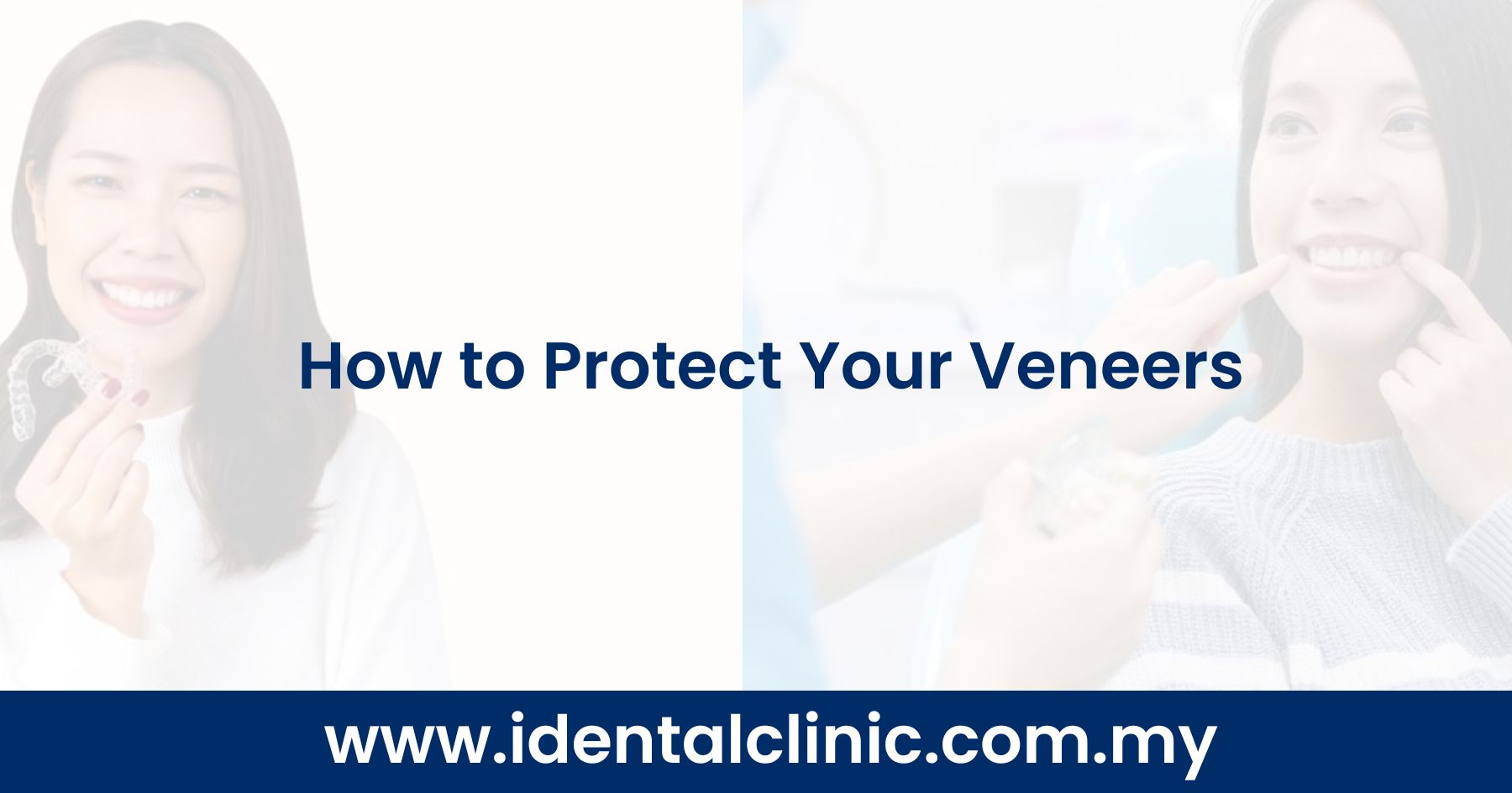 How to Protect Your Veneers