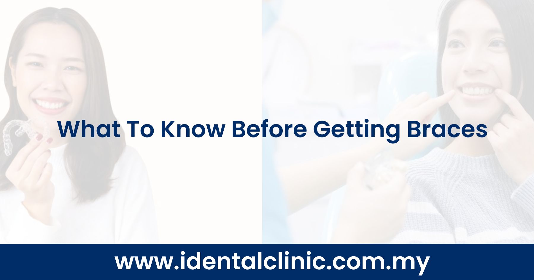 What To Know Before Getting Braces